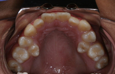 Before image