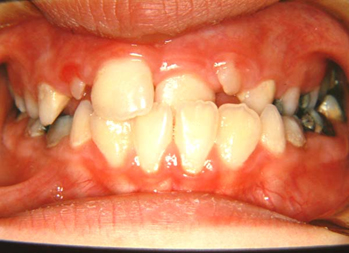 Before image