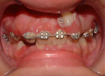 Before image