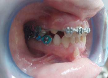 Before image