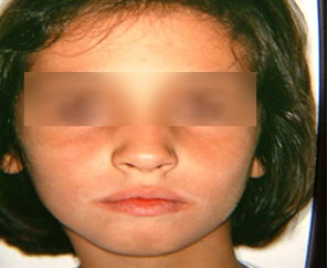 After image