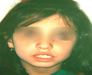 Before image