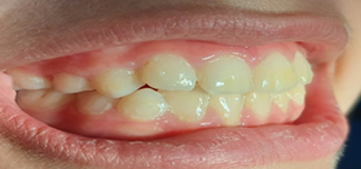 After image