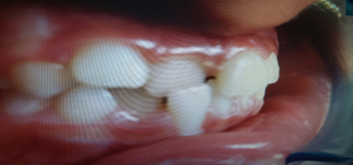 Before image