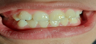 After image