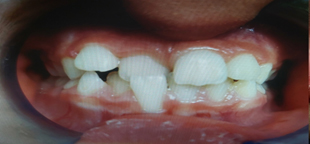 Before image