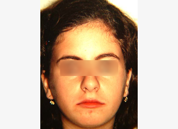 After image