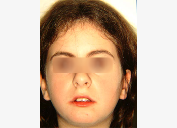 Before image