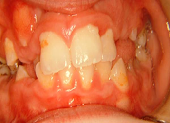 Before image