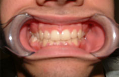 After image