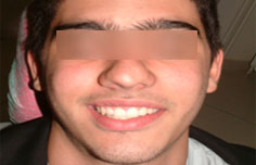 After image