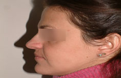 After image
