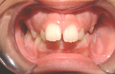 Before image