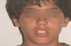 Before image