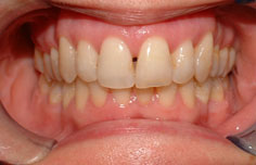 After image