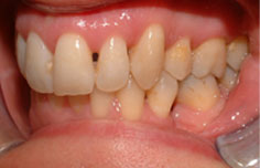 After image