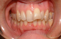 Before image