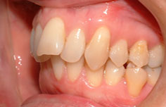 Before image