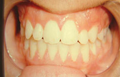 After image