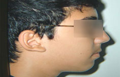 After image