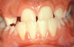 Before image