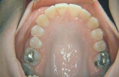 After image