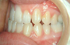 After image