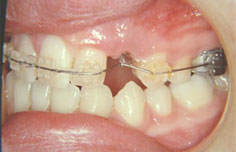 Before image