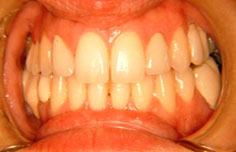 After image
