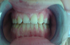 After image