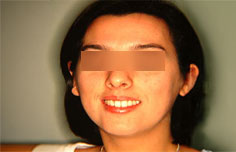 After image