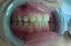 After image
