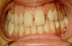 Before image