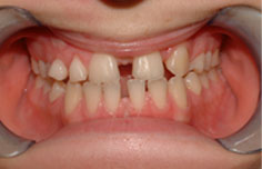 Before image