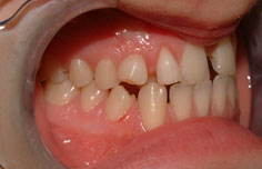 Before image
