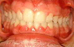 After image