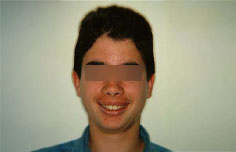 After image
