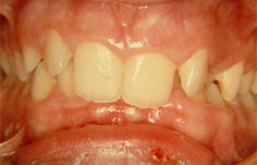 Before image