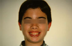 Before image