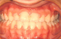 After image