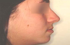 After image