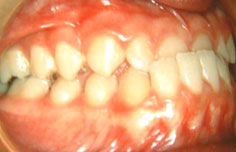 Before image