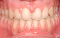 After image