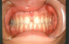 Before image