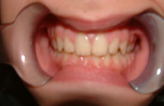 After image