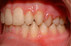 After image