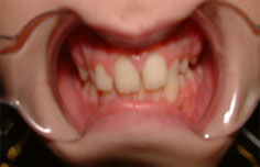 Before image