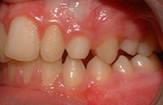 Before image