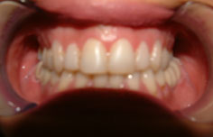After image