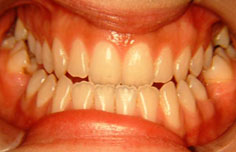Before image
